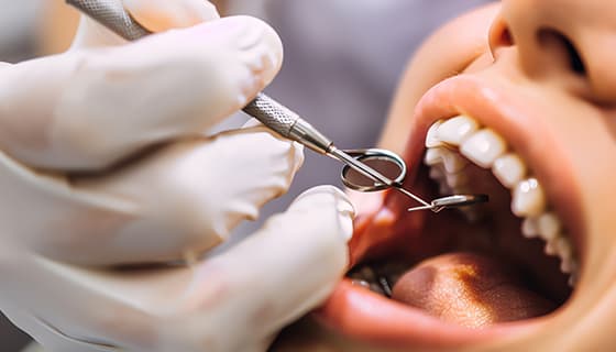 牙医给年轻女士检查牙齿图片素材(JPG)